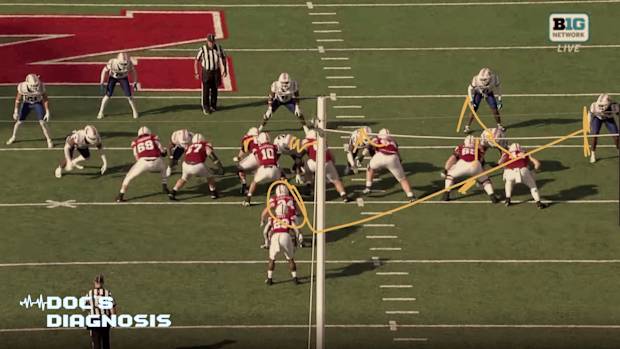 Docs Diagnosis thumbnail run blocking 2023 La Tech